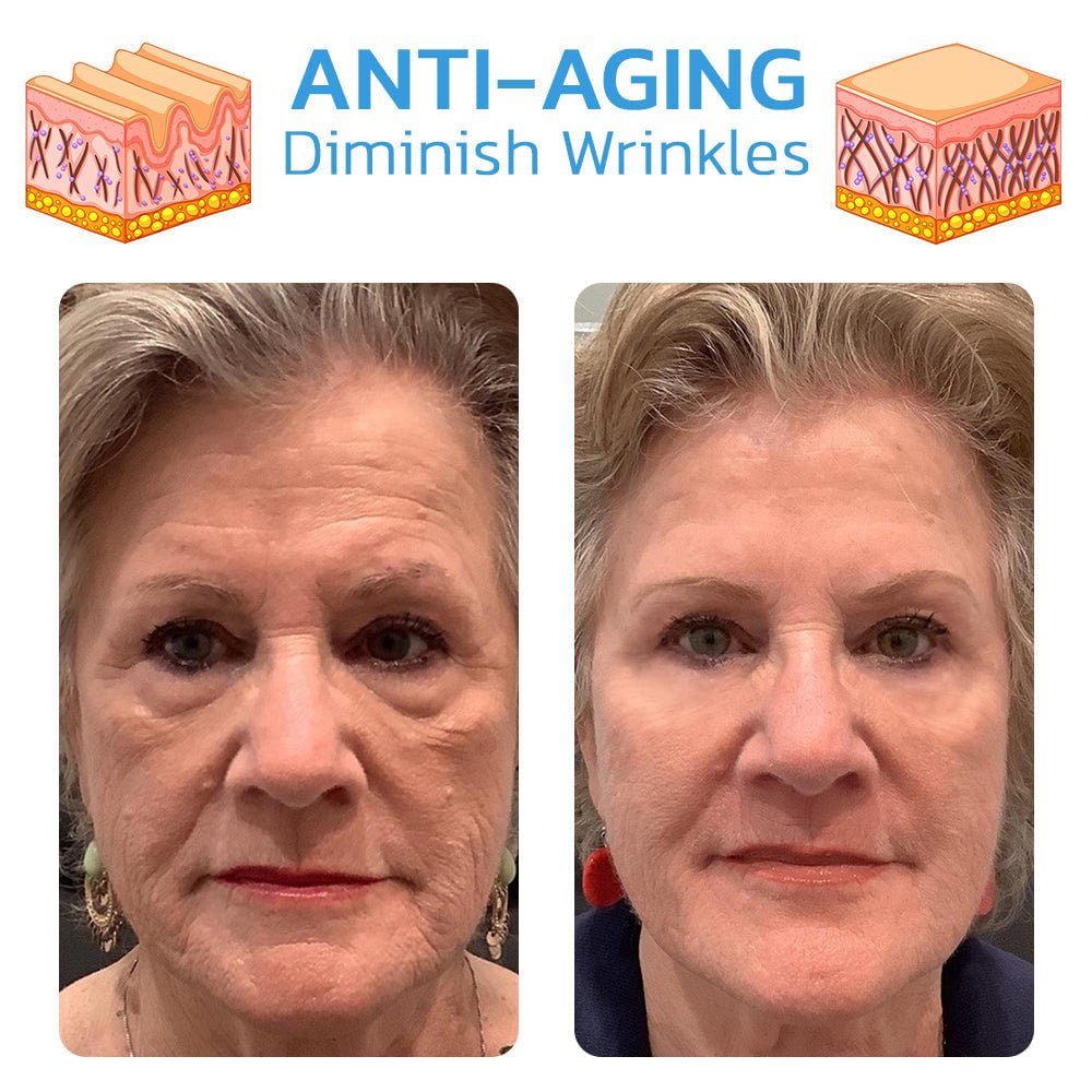 30 Days Anti-Aging Treatment Serum